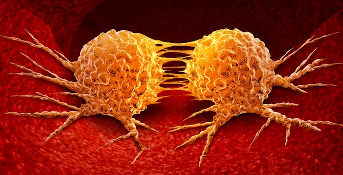 What is Metastasis?