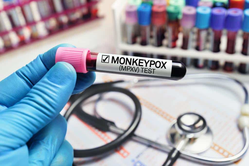 What is Monkeypox?