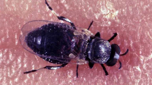 What is Onchocerciasis