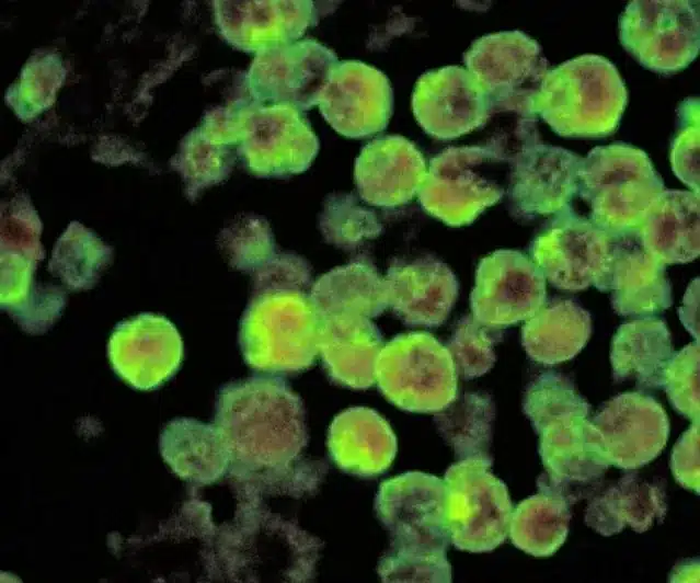 Naegleria fowleri or brain-eating amoeba