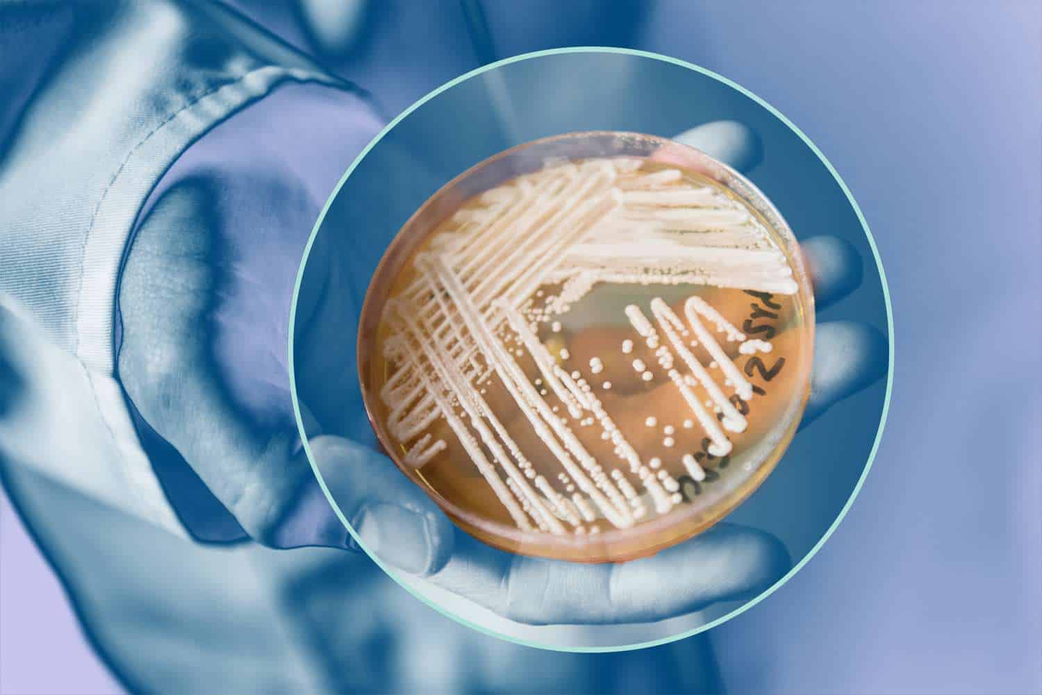 Candida auris