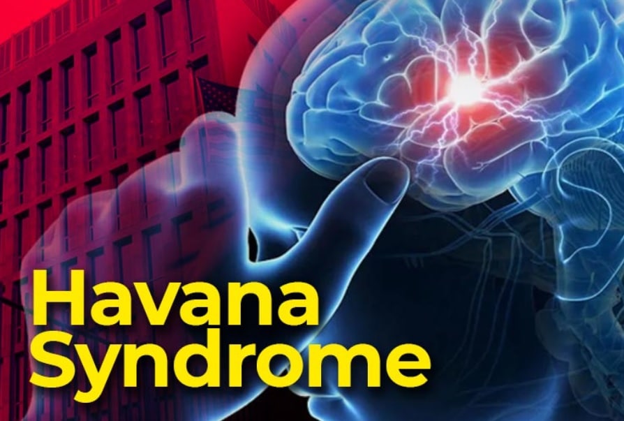 Havana Syndrome