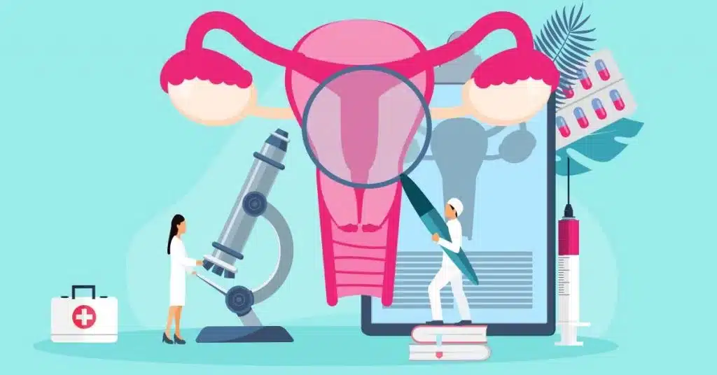 Cervical cancer
