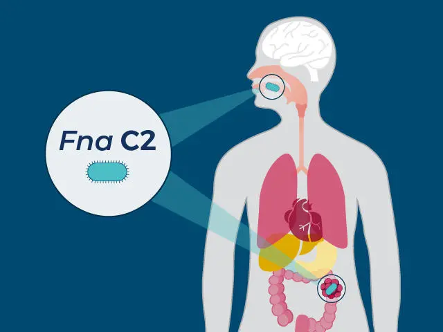 Fusobacterium Nucleatum