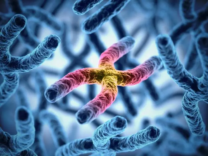 Gaucher disease