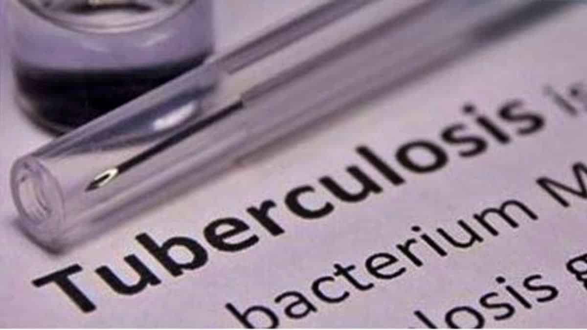 Global TB Report 2023: India had Highest Number of TB Cases Globally in 2022