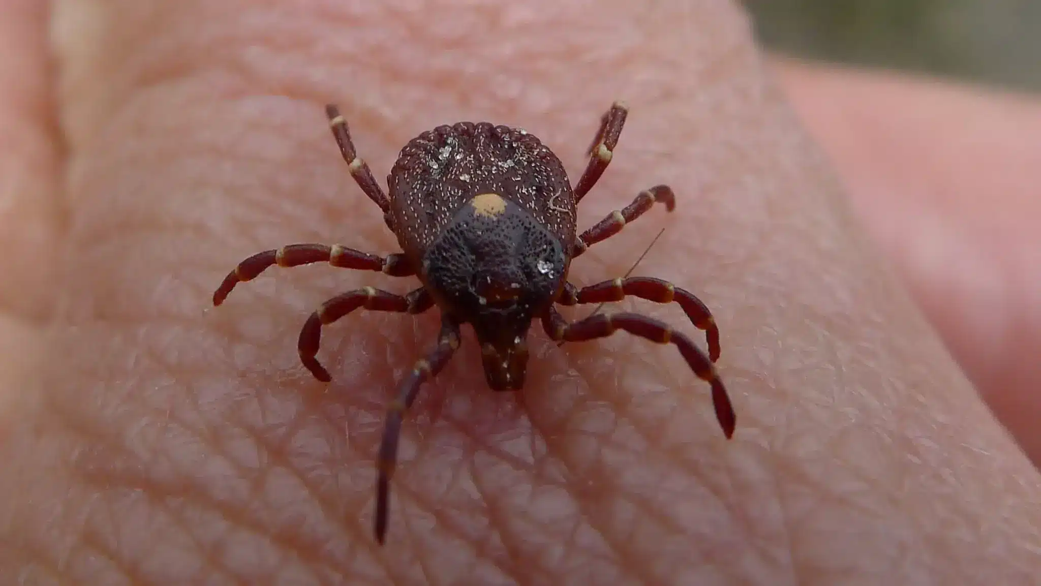 Kyasanur Forest Disease