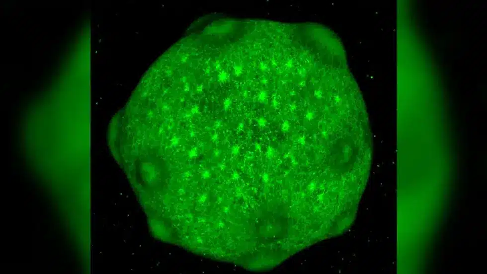 Lab-grown Minibrains