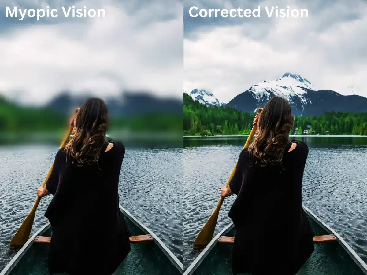 What is Myopia?