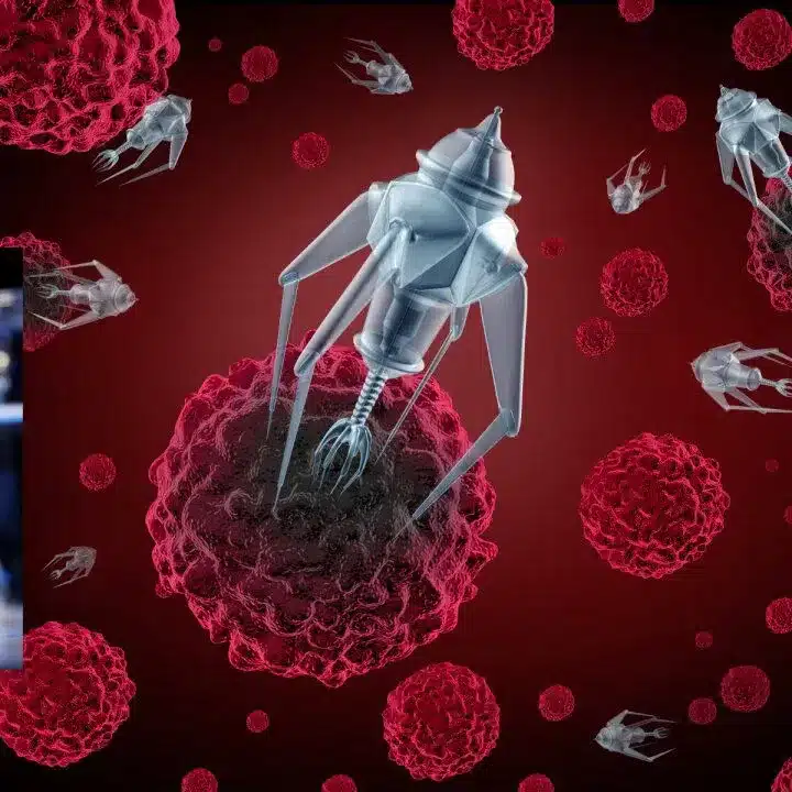 Nanoparticle Drug Delivery Systems