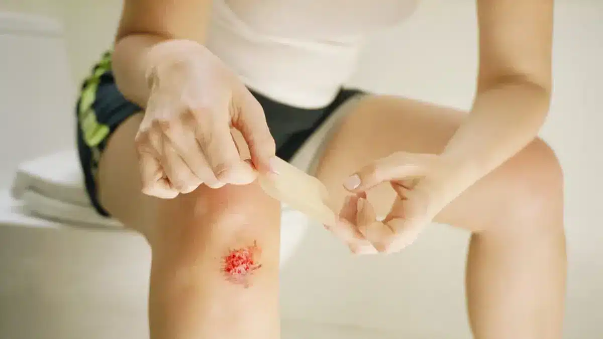 What is Necrotising fasciitis?