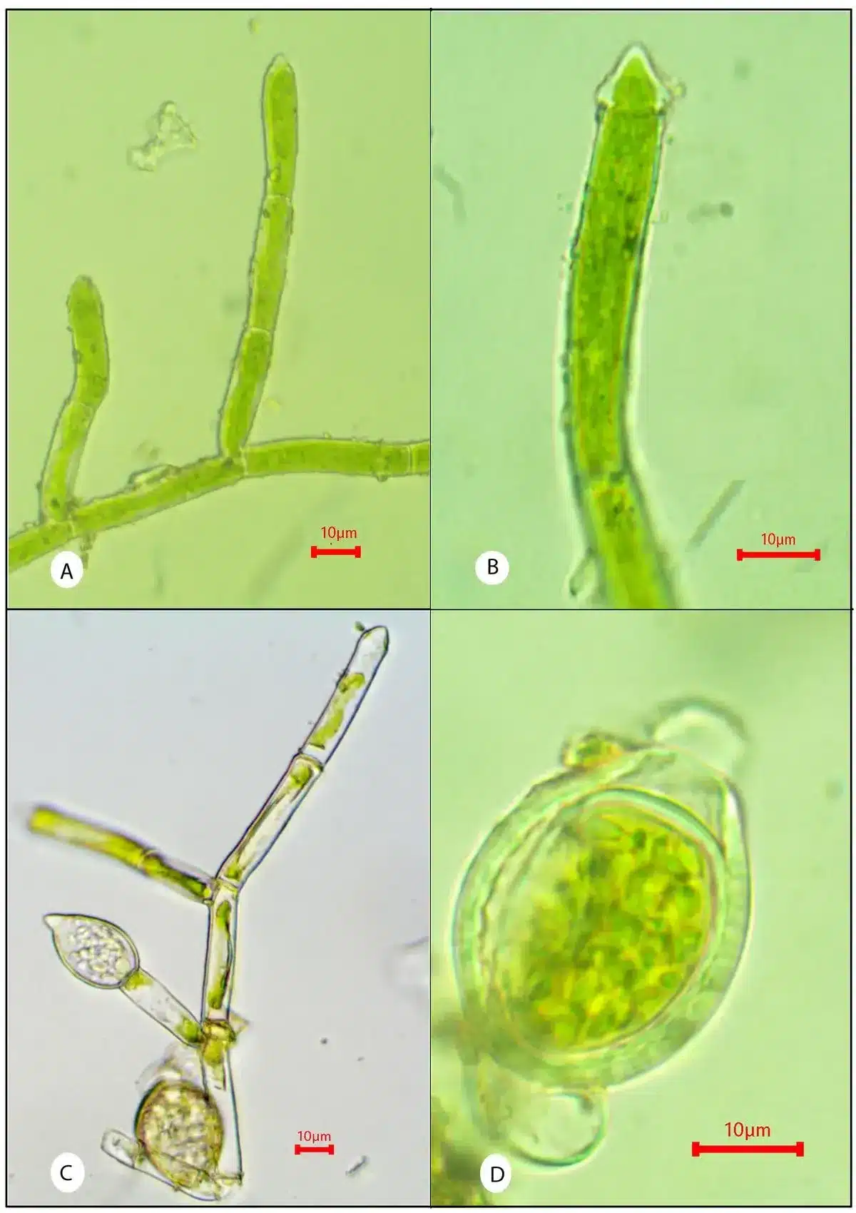 Oedocladium sahyadricum