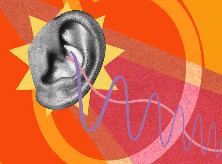 Sensorineural deafness