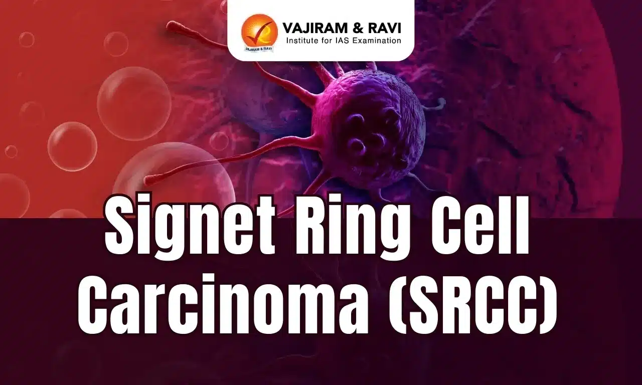 Signet Ring Cell Carcinoma (SRCC)