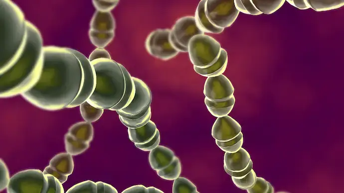 Streptococcal Toxic Shock Syndrome (STSS)