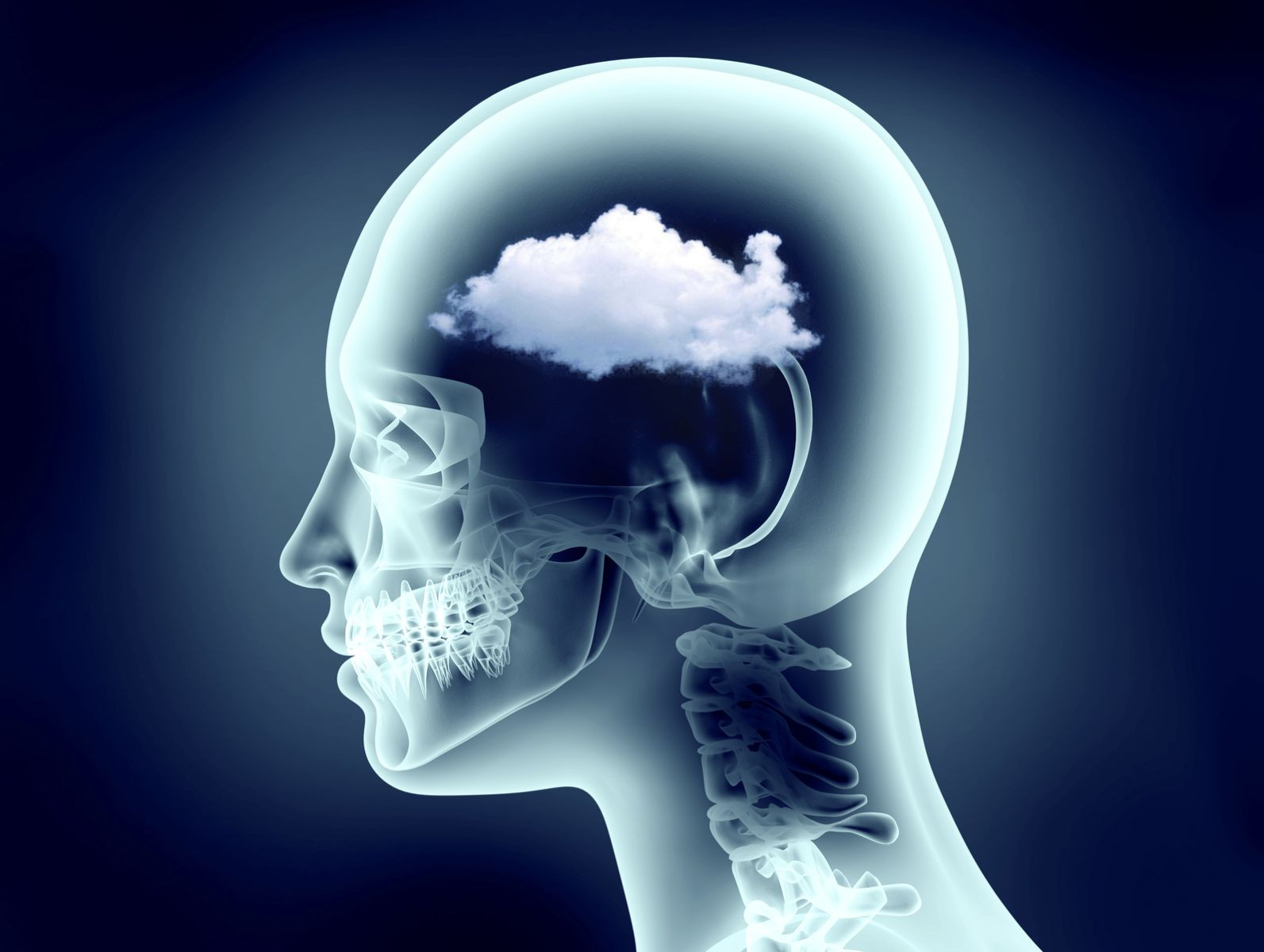 What is Brain Fog?