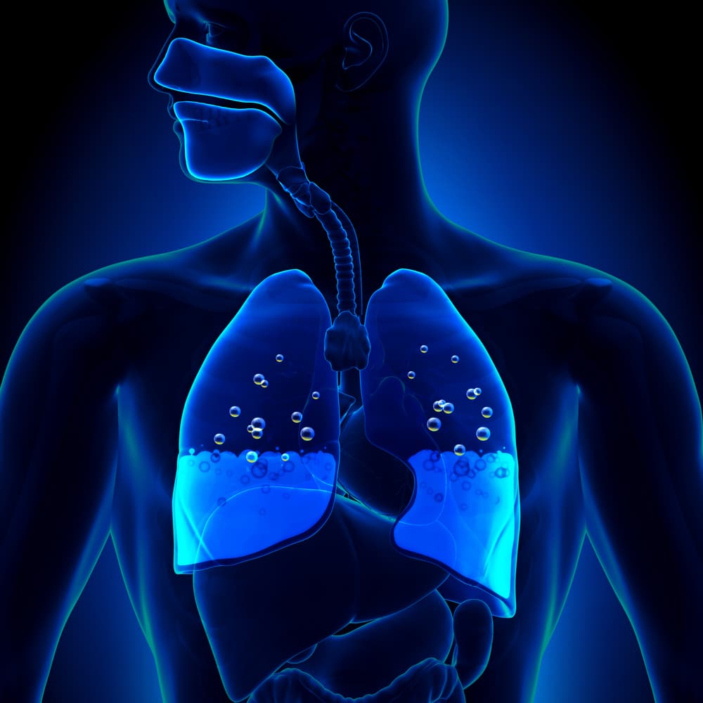 What is Chronic Obstructive Pulmonary Disease (COPD)?