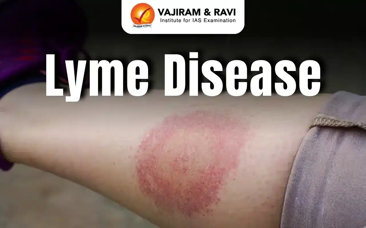 Lyme Disease