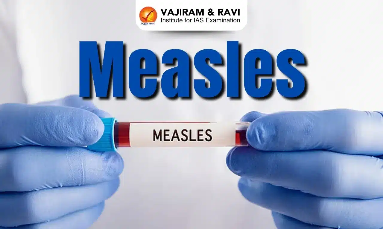Measles