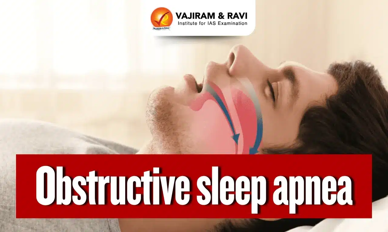 Obstructive Sleep Apnea