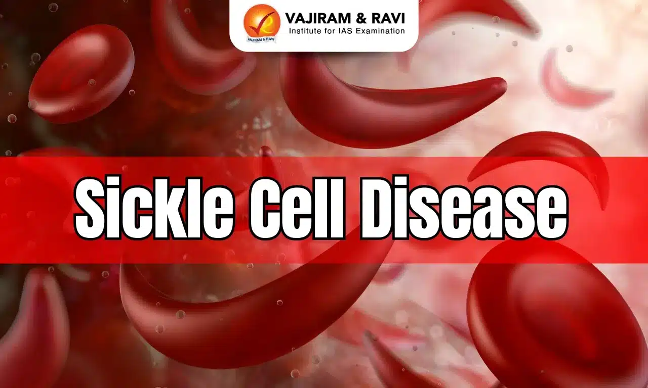 Sickle Cell Disease