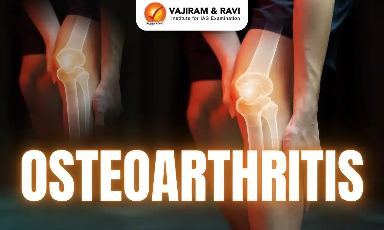 Osteoarthritis