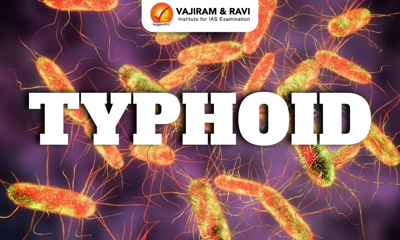 Typhoid