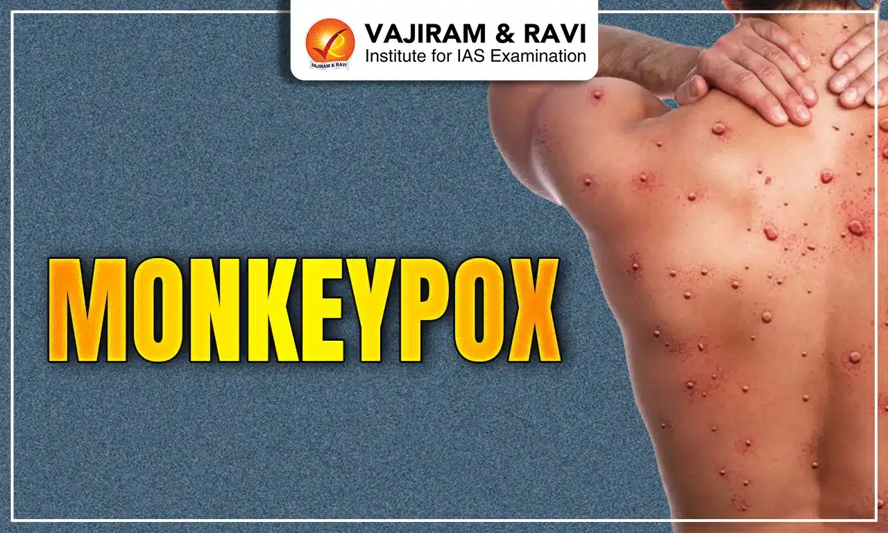 Monkeypox